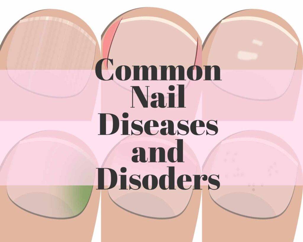 Estero Town Common Nail Care - wide 7