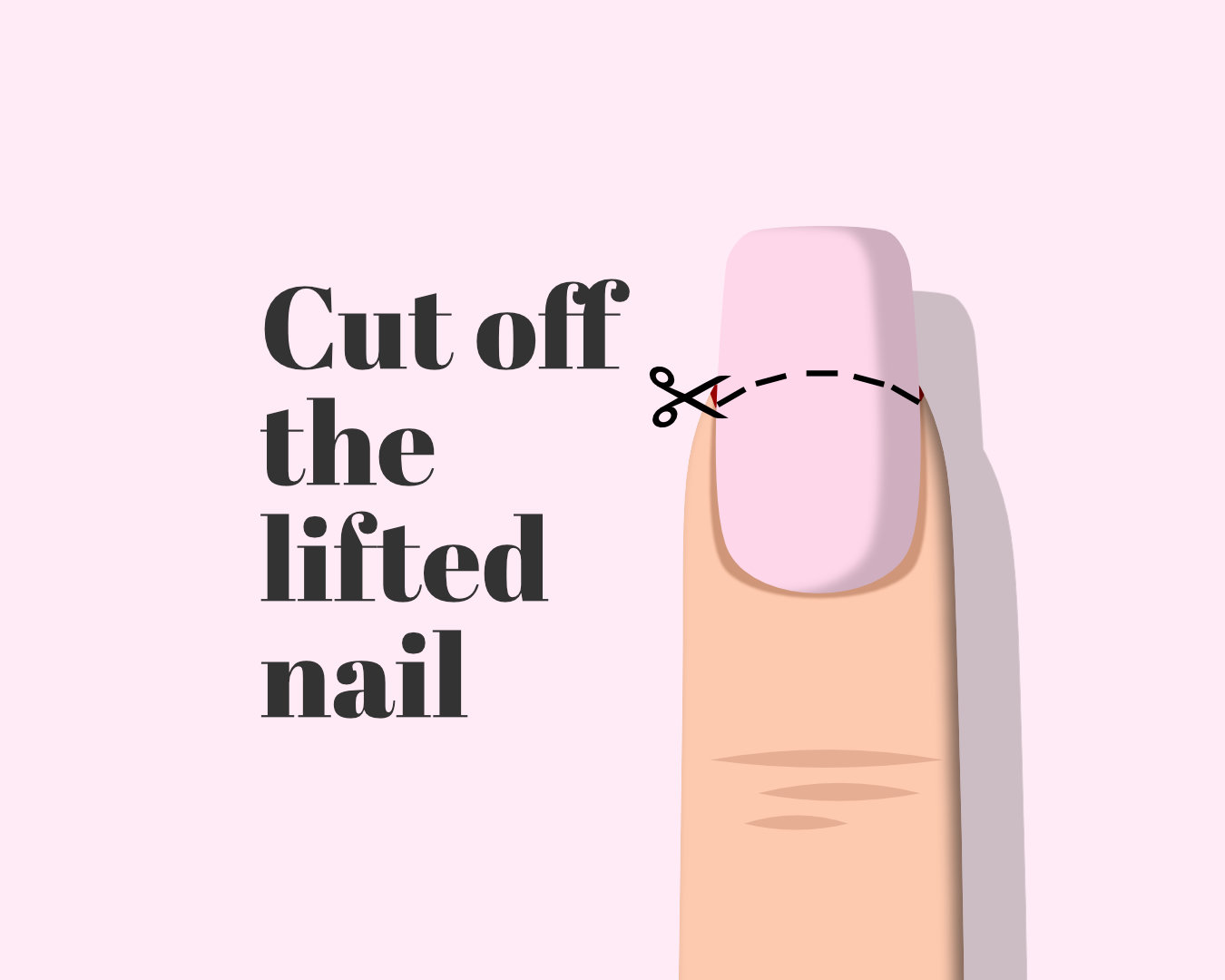 How to remove acrylic when your real nail is ripped? – The Nail Tech ...