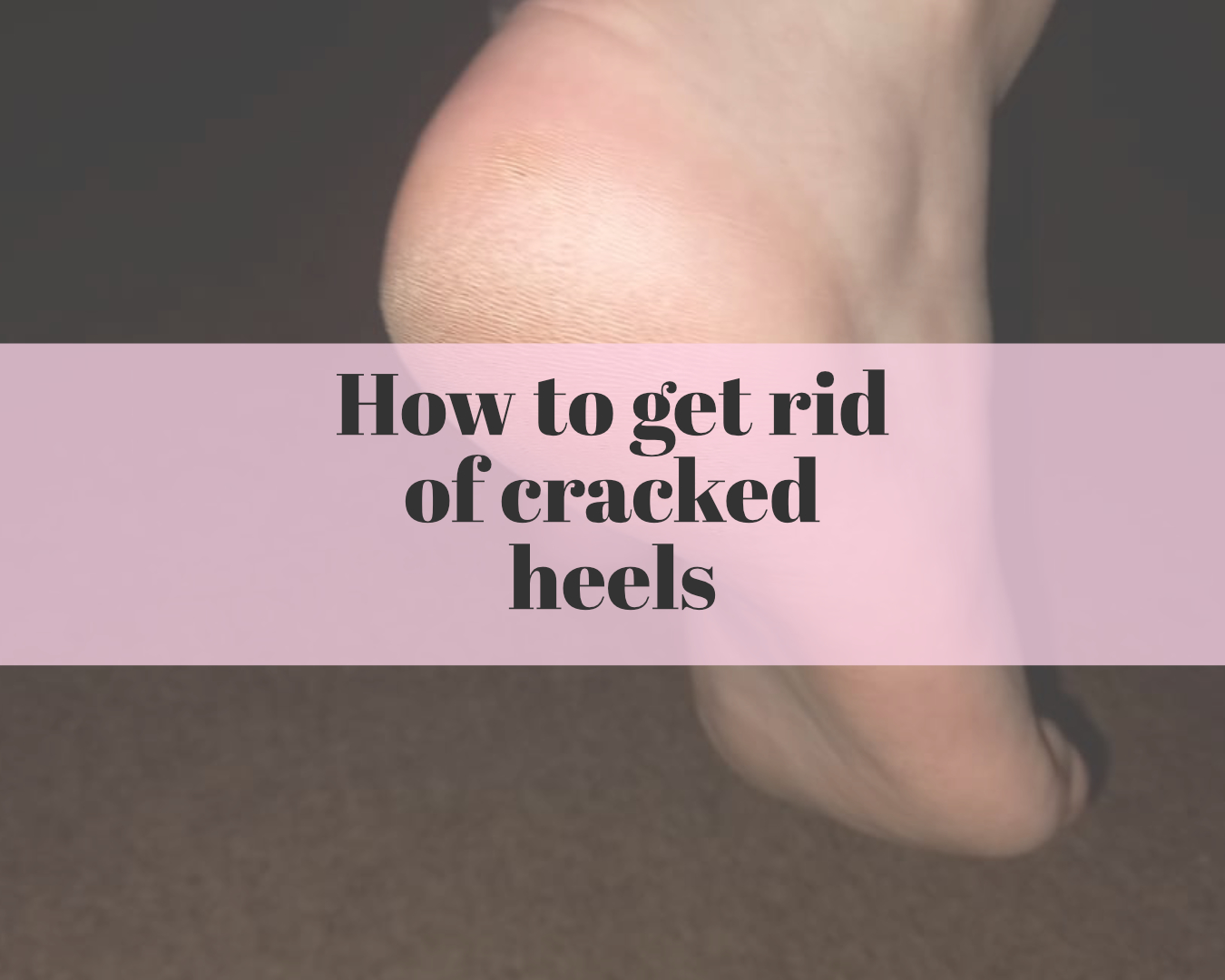 How to get rid of cracked heels