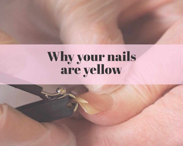 Why your nails are yellow